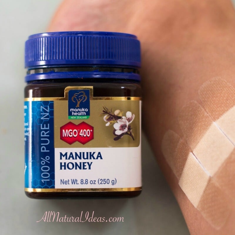 Manuka honey healing