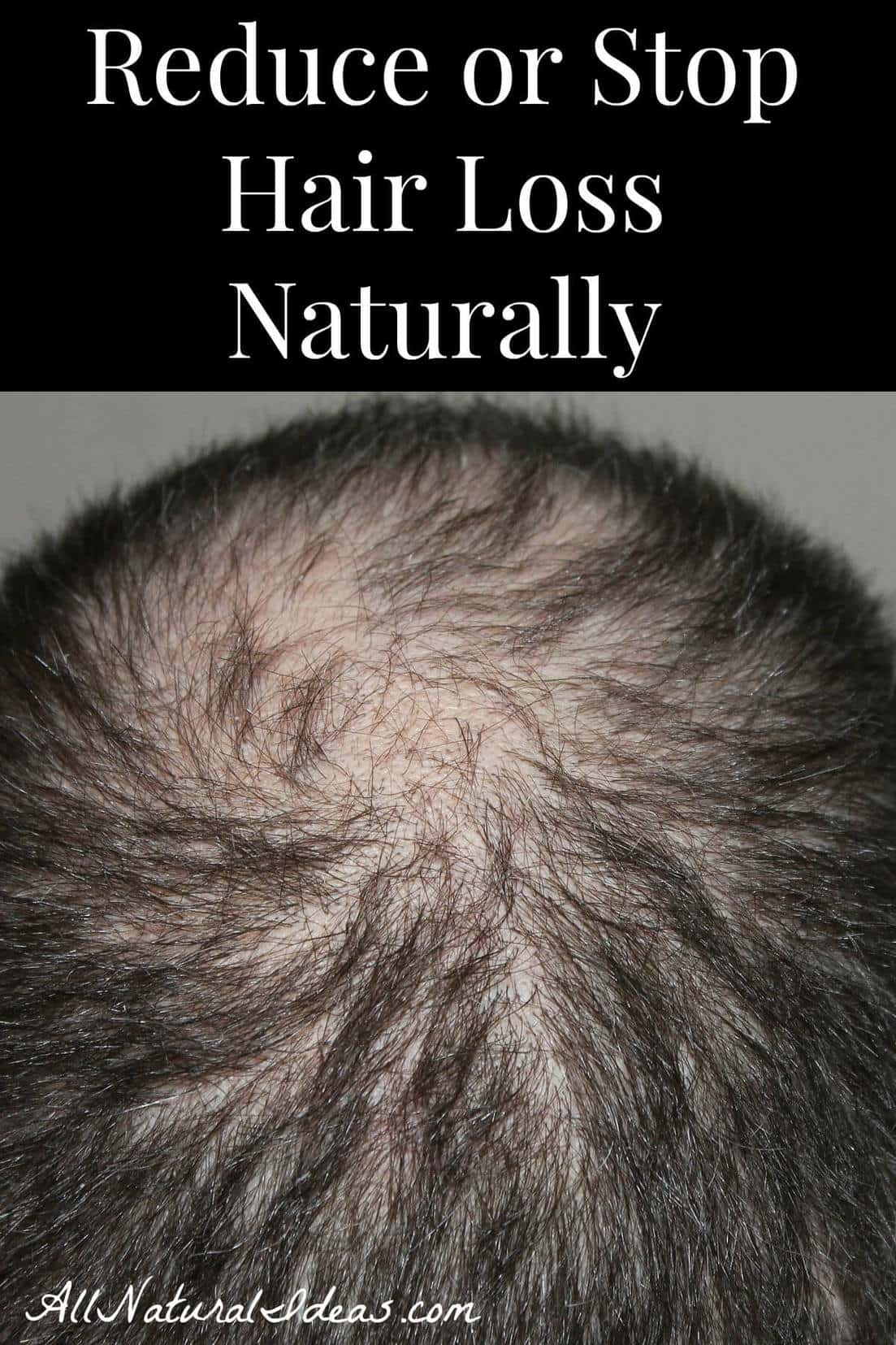 Both old and young people are at risk of losing their hair. A few key steps can stop or reduce hair loss naturally. No one should have to lose their hair.