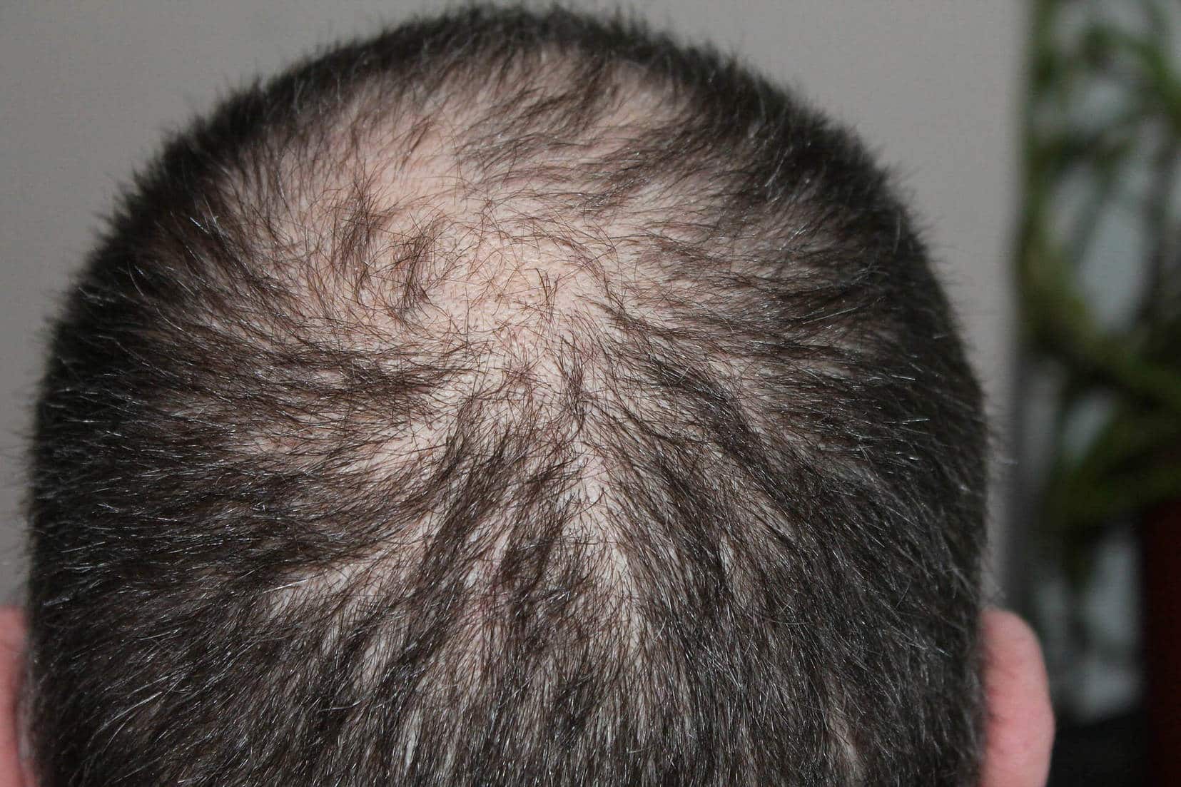 Stop or reduce hair loss naturally