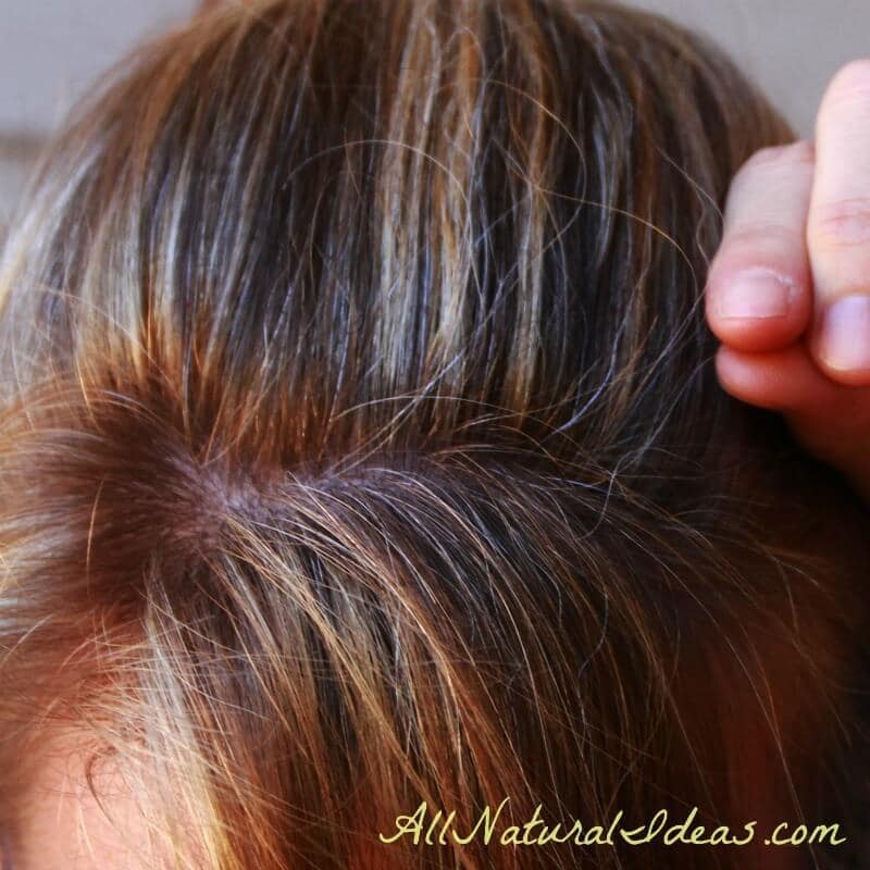 Natural remedies for gray hair