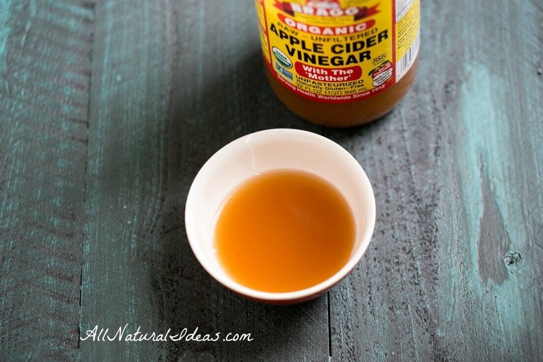 ACV