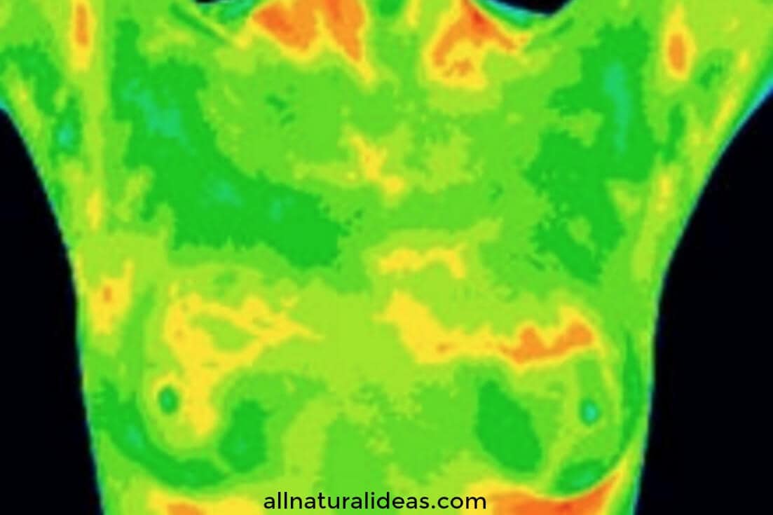 Thermography scan front breast