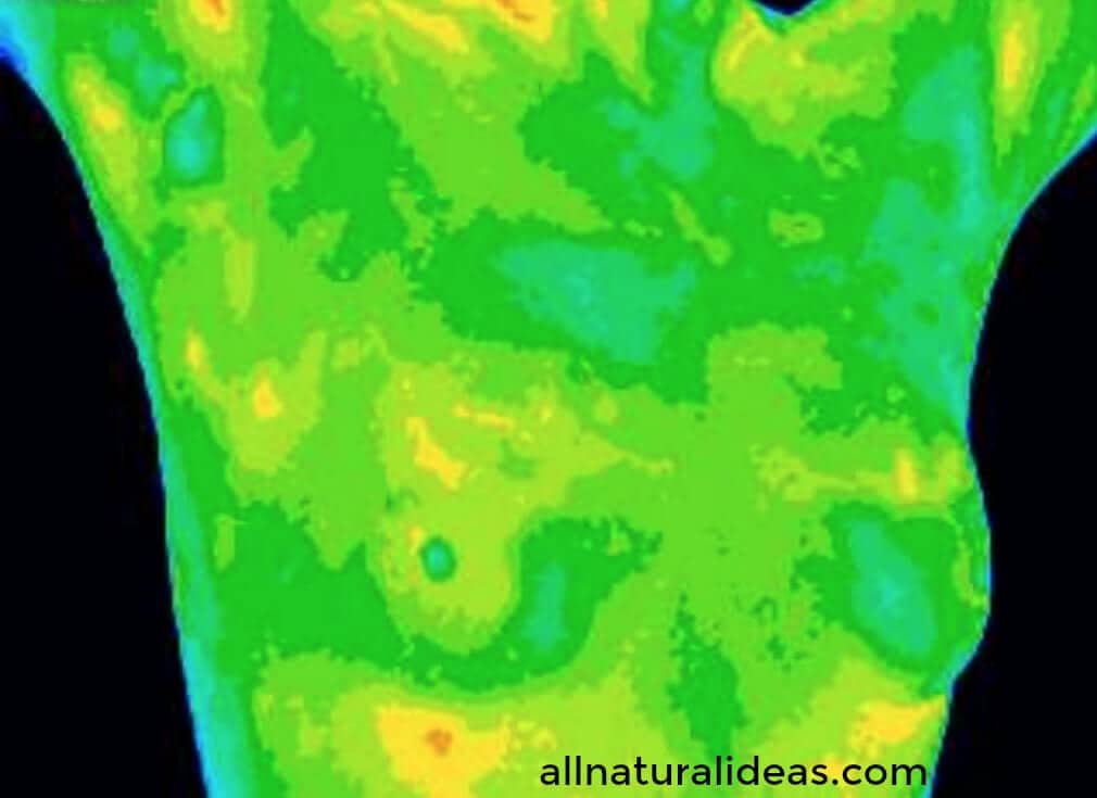 Thermography scan angle breast