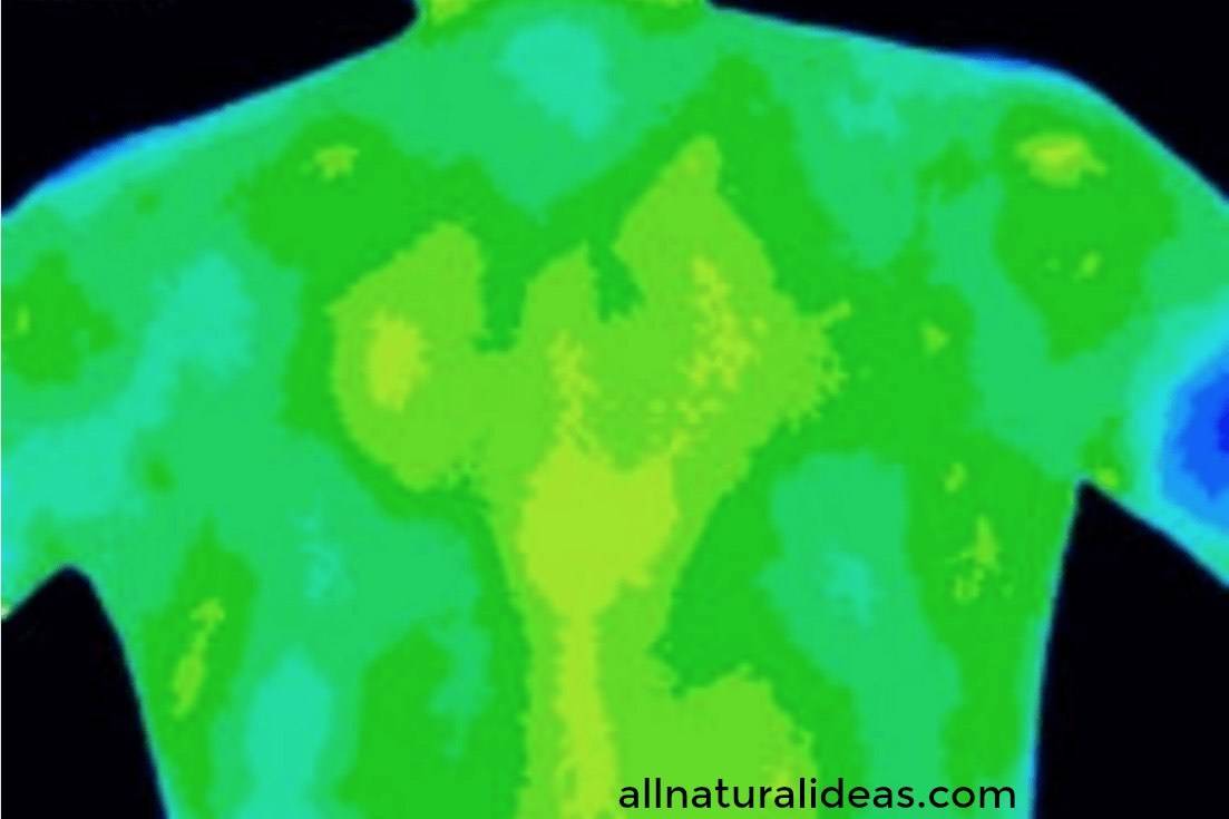 Thermography scan body back