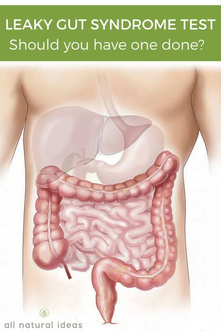 Is a leaky gut syndrome test even needed?
