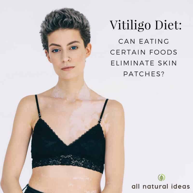 Vitiligo diet may reduce or even eliminate blotchy, white patches. But certain foods, even ones that are considered healthy have to be avoided.