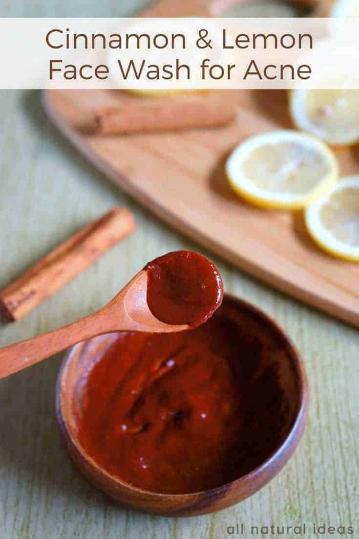 homemade face was for acne