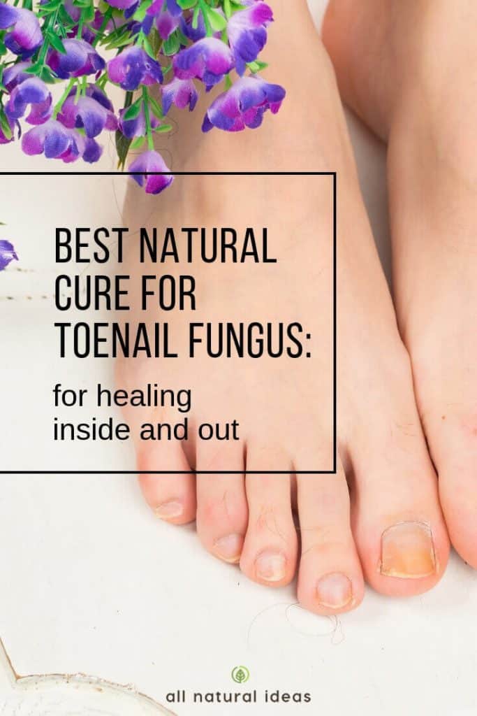 Looking for the best natural cure for toenail fungus? Think about treating it from the inside out, too.